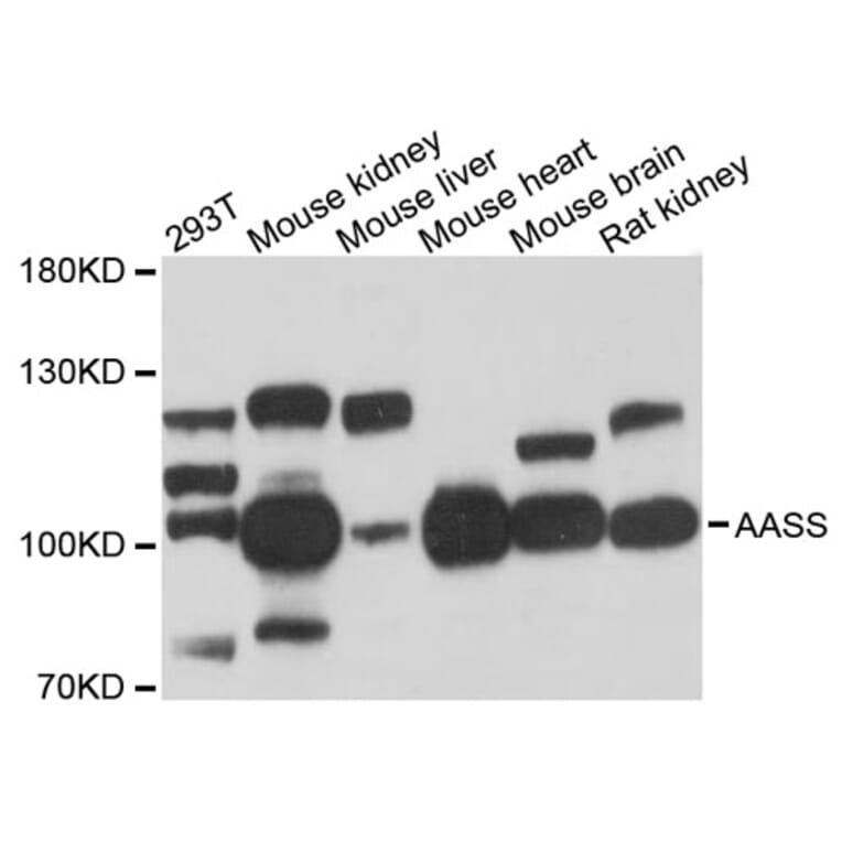 Western Blot - Anti-AASS Antibody (A12863) - Antibodies.com