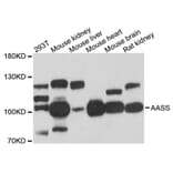 Western Blot - Anti-AASS Antibody (A12863) - Antibodies.com