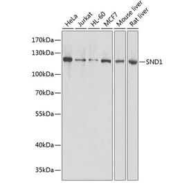 Western Blot - Anti-SND1 Antibody (A87740) - Antibodies.com