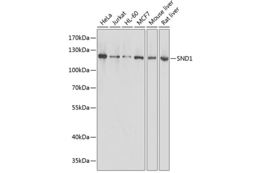 Western Blot - Anti-SND1 Antibody (A87740) - Antibodies.com