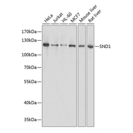 Western Blot - Anti-SND1 Antibody (A87740) - Antibodies.com