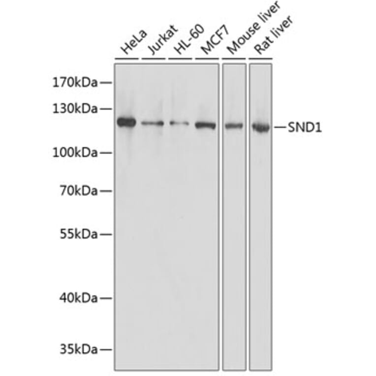 Western Blot - Anti-SND1 Antibody (A87740) - Antibodies.com