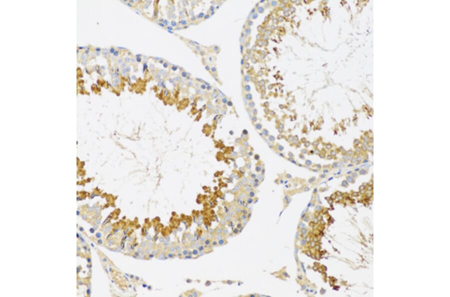 Immunohistochemistry - Anti-SRPK1 Antibody (A12510) - Antibodies.com