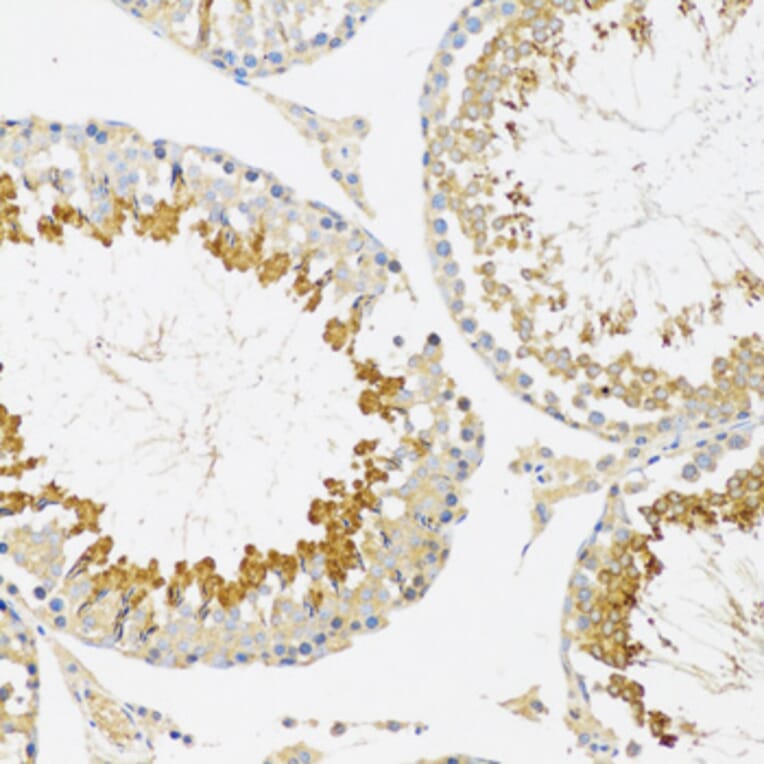 Immunohistochemistry - Anti-SRPK1 Antibody (A12510) - Antibodies.com