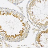 Immunohistochemistry - Anti-SRPK1 Antibody (A12510) - Antibodies.com