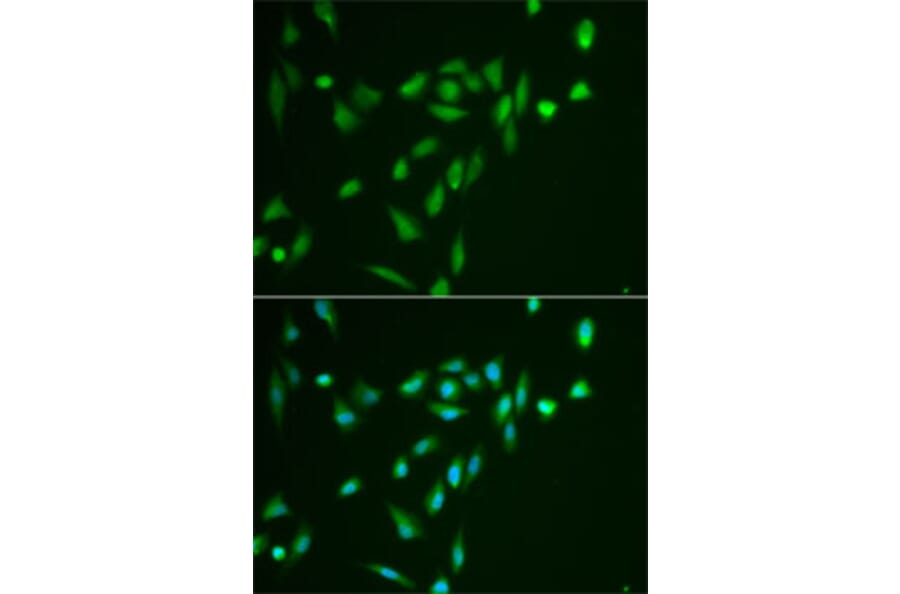 Immunofluorescence - Anti-SRPK1 Antibody (A12510) - Antibodies.com