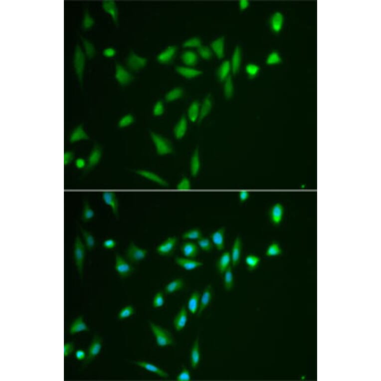 Immunofluorescence - Anti-SRPK1 Antibody (A12510) - Antibodies.com