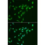 Immunofluorescence - Anti-SRPK1 Antibody (A12510) - Antibodies.com