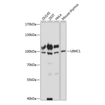 Western Blot - Anti-RAP80 Antibody (A87742) - Antibodies.com