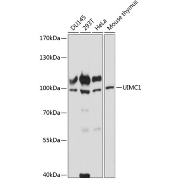 Western Blot - Anti-RAP80 Antibody (A87742) - Antibodies.com