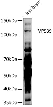 Western blot analysis of extracts of various cell lines, using Anti-VPS39 Antibody (A13082) at 1:3000 dilution.
Secondary antibody: Goat Anti-Rabbit IgG (H+L) (HRP) (AS014) at 1:10,000 dilution.
Lysates / proteins: 25µg per lane.
Blocking buffer: 3% non-fat dry milk in TBST.
Detection: ECL Enhanced Kit (RM00021).
Exposure time: 90s.