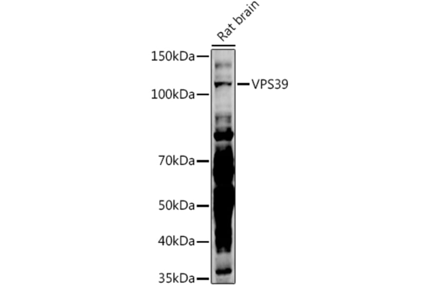 Western Blot - Anti-VPS39 Antibody (A87743) - Antibodies.com