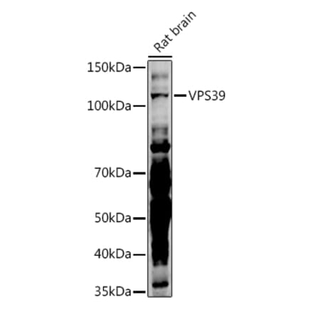 Western Blot - Anti-VPS39 Antibody (A87743) - Antibodies.com