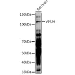 Western Blot - Anti-VPS39 Antibody (A87743) - Antibodies.com