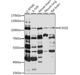 Western Blot - Anti-KCNQ5 Antibody (A87744) - Antibodies.com