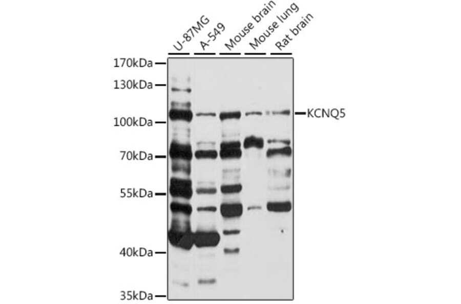 Western Blot - Anti-KCNQ5 Antibody (A87744) - Antibodies.com