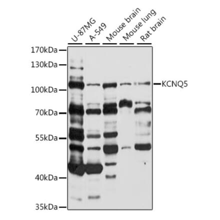 Western Blot - Anti-KCNQ5 Antibody (A87744) - Antibodies.com