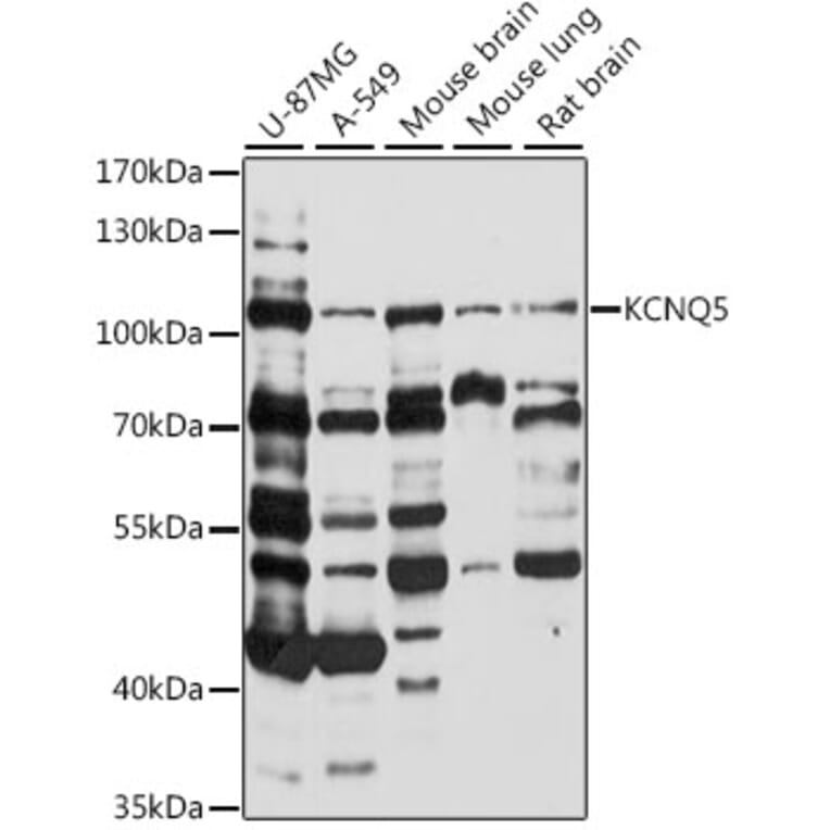 Western Blot - Anti-KCNQ5 Antibody (A87744) - Antibodies.com
