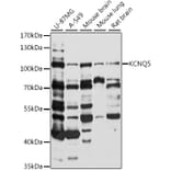 Western Blot - Anti-KCNQ5 Antibody (A87744) - Antibodies.com