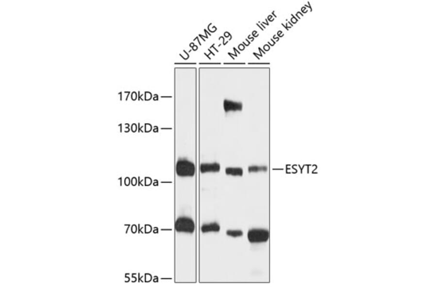 Western Blot - Anti-FAM62B Antibody (A87745) - Antibodies.com