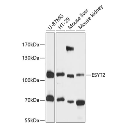 Western Blot - Anti-FAM62B Antibody (A87745) - Antibodies.com