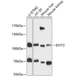 Western Blot - Anti-FAM62B Antibody (A87745) - Antibodies.com