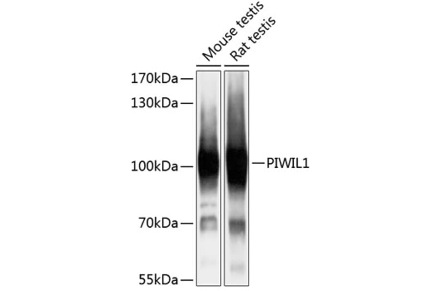Western Blot - Anti-PIWIL1 Antibody (A87746) - Antibodies.com