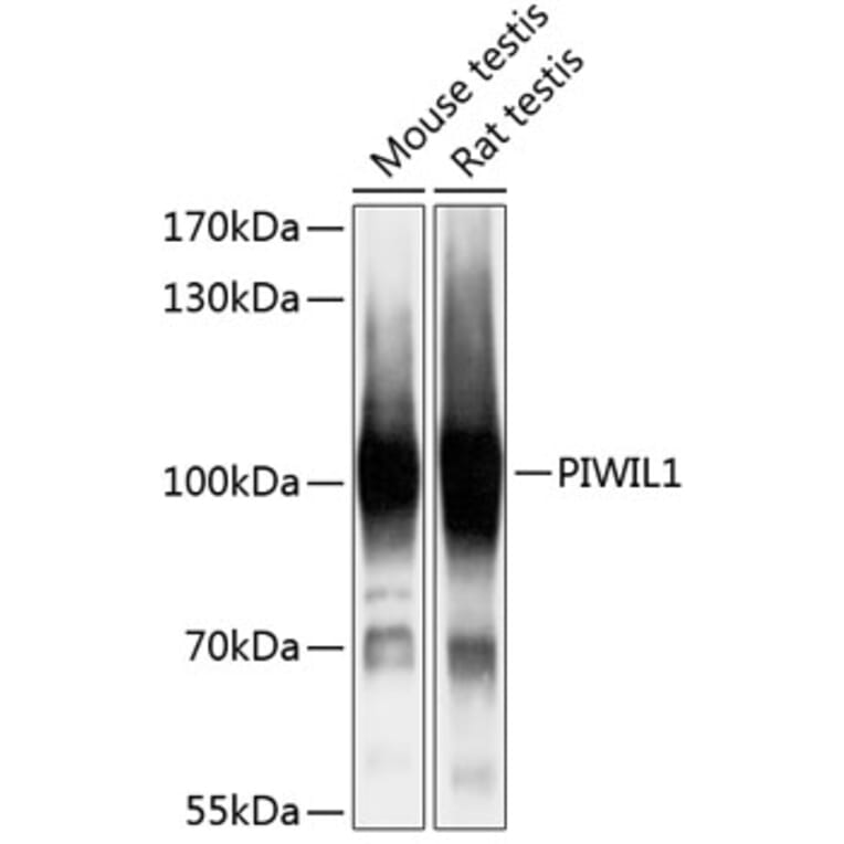 Western Blot - Anti-PIWIL1 Antibody (A87746) - Antibodies.com