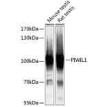 Western Blot - Anti-PIWIL1 Antibody (A87746) - Antibodies.com