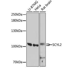 Western Blot - Anti-SCYL2 Antibody (A87748) - Antibodies.com