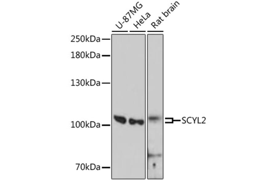 Western Blot - Anti-SCYL2 Antibody (A87748) - Antibodies.com