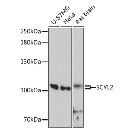 Western Blot - Anti-SCYL2 Antibody (A87748) - Antibodies.com