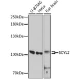 Western Blot - Anti-SCYL2 Antibody (A87748) - Antibodies.com