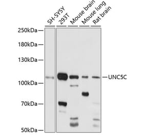 Western Blot - Anti-UNC5C Antibody (A87749) - Antibodies.com