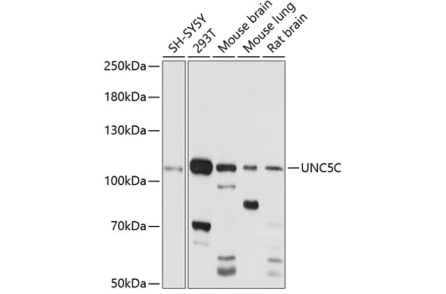 Western Blot - Anti-UNC5C Antibody (A87749) - Antibodies.com