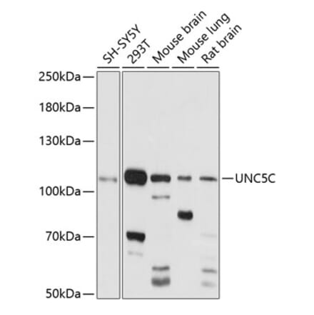 Western Blot - Anti-UNC5C Antibody (A87749) - Antibodies.com