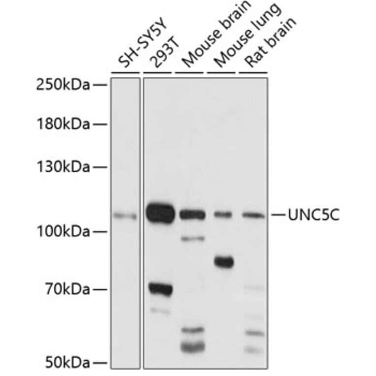 Western Blot - Anti-UNC5C Antibody (A87749) - Antibodies.com