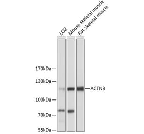 Western Blot - Anti-ACTN3 Antibody (A87750) - Antibodies.com