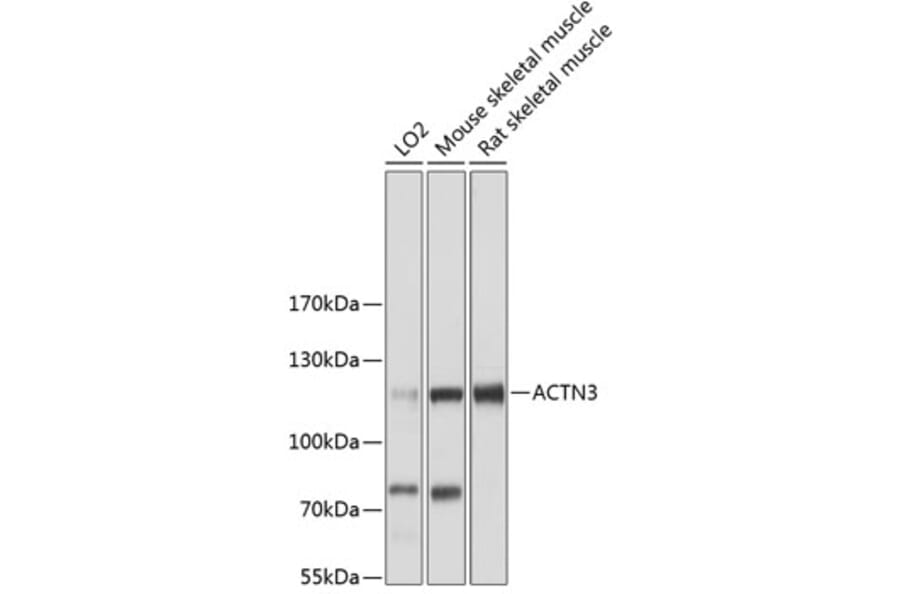 Western Blot - Anti-ACTN3 Antibody (A87750) - Antibodies.com