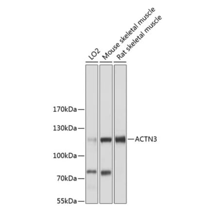 Western Blot - Anti-ACTN3 Antibody (A87750) - Antibodies.com