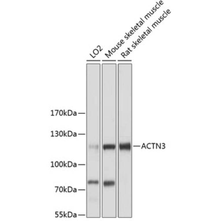 Western Blot - Anti-ACTN3 Antibody (A87750) - Antibodies.com