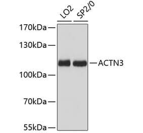 Western Blot - Anti-ACTN3 Antibody (A87751) - Antibodies.com