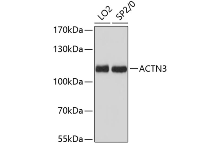 Western Blot - Anti-ACTN3 Antibody (A87751) - Antibodies.com