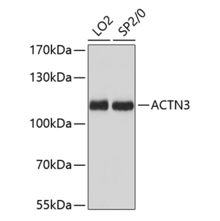 Western Blot - Anti-ACTN3 Antibody (A87751) - Antibodies.com