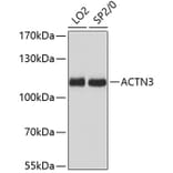 Western Blot - Anti-ACTN3 Antibody (A87751) - Antibodies.com