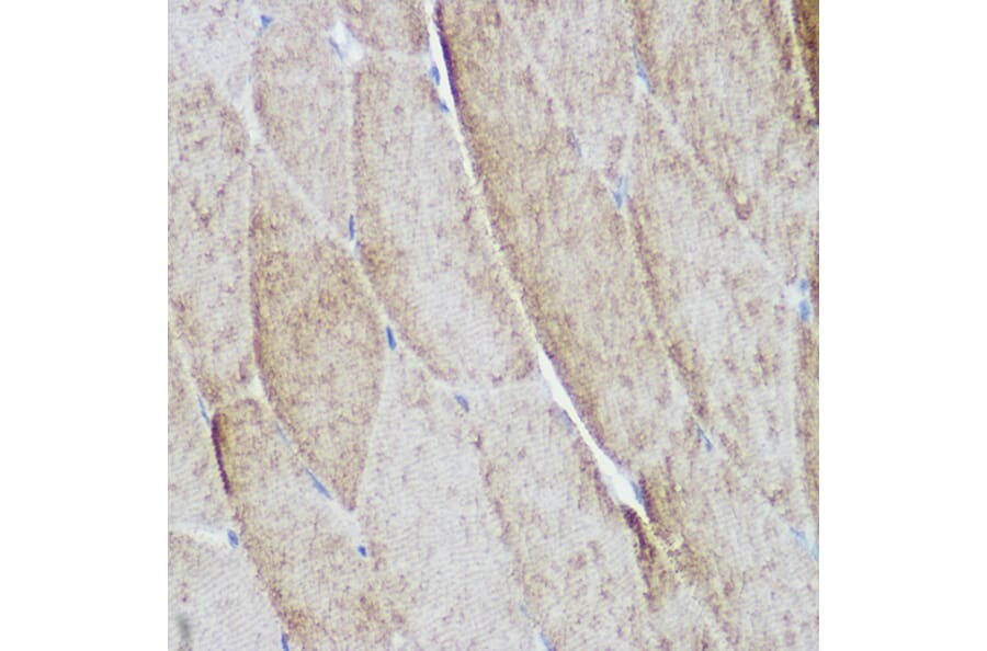 Immunohistochemistry - Anti-ACTN3 Antibody (A87751) - Antibodies.com