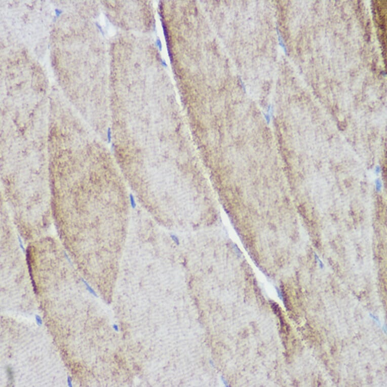 Immunohistochemistry - Anti-ACTN3 Antibody (A87751) - Antibodies.com