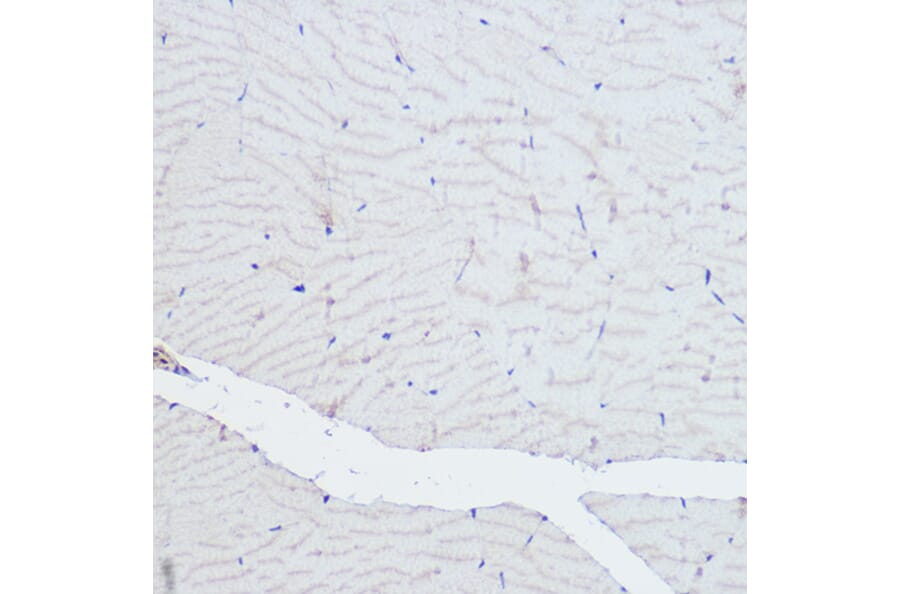 Immunohistochemistry - Anti-ACTN3 Antibody (A87751) - Antibodies.com
