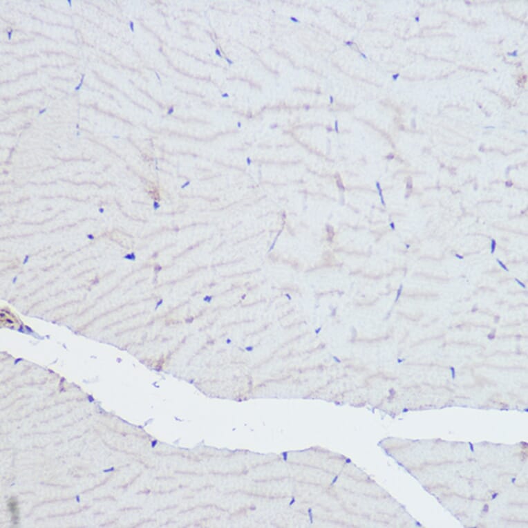 Immunohistochemistry - Anti-ACTN3 Antibody (A87751) - Antibodies.com