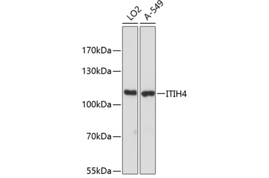 Western Blot - Anti-ITIH4 Antibody (A87752) - Antibodies.com